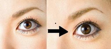 眼睛发黄的图片,揭秘眼睛发黄背后的健康信号