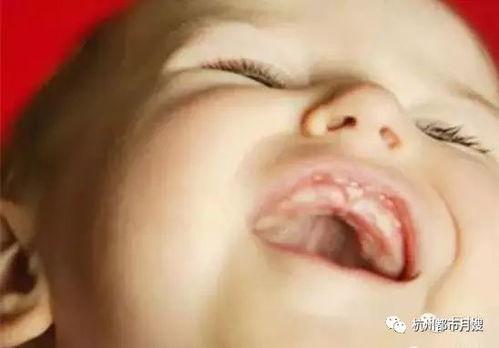 婴儿长马牙图片,揭秘这一常见现象的真相与护理方法